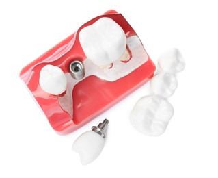 Photo of Educational model with teeth near dental implant and crowns on white background, top view