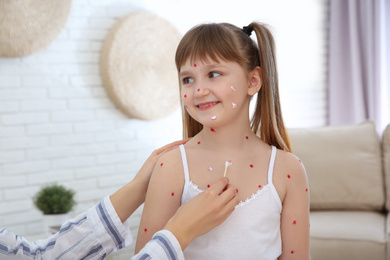 Photo of Woman applying cream onto skin of little girl with chickenpox at home