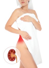 Woman with kidney stones disease on white background