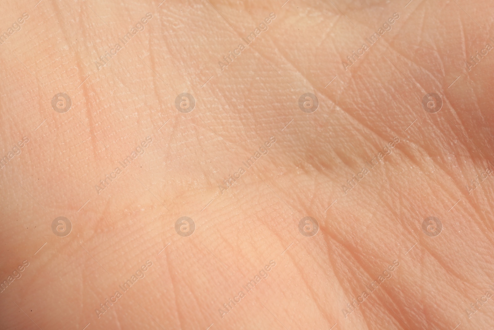 Photo of Texture of dry skin as background, macro view