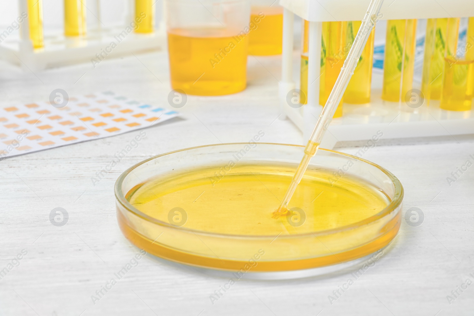 Photo of Taking urine sample from dish on table, closeup. Urology concept