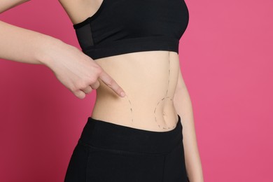 Photo of Slim woman with marks on body against pink background, closeup. Weight loss surgery