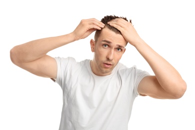 Young man with hair loss problem on white background