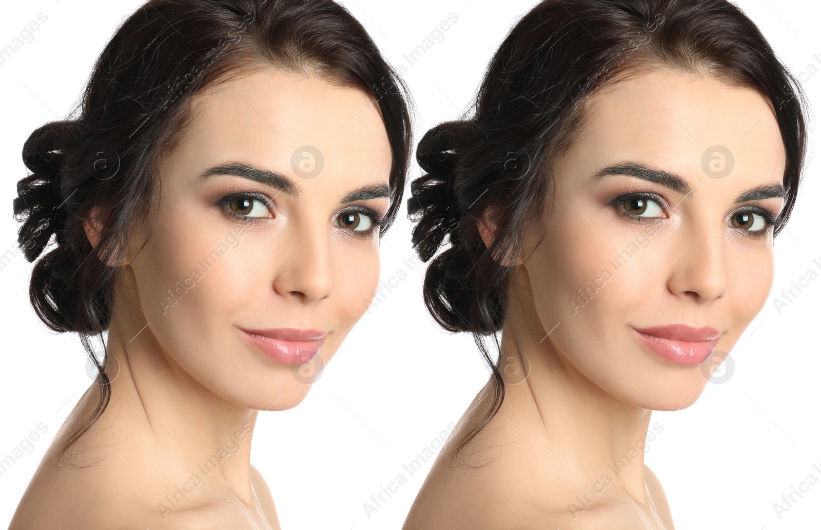 Image of Woman before and after lip correction procedure on white background