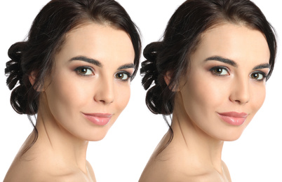 Image of Woman before and after lip correction procedure on white background