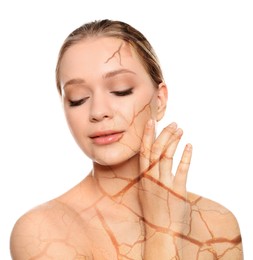 Young woman with body dry skin problem on white background