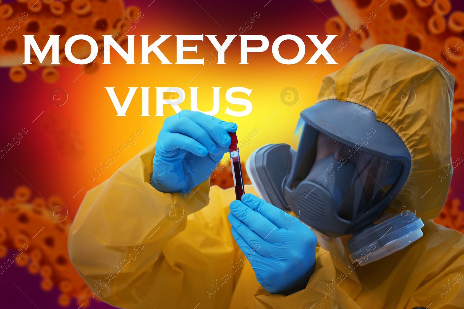 Image of Scientist in chemical protective suit holding test tube with blood sample. Monkeypox virus