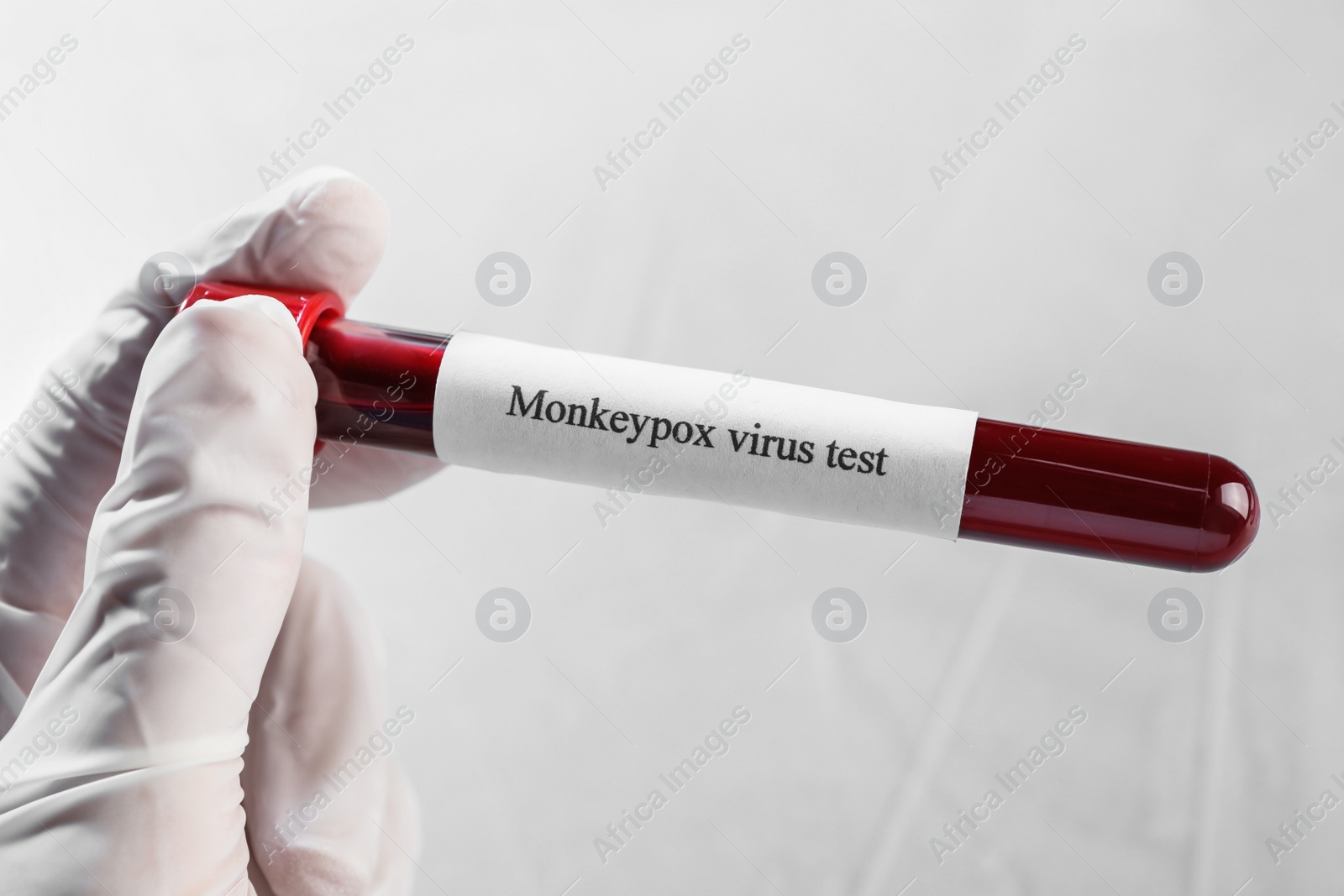 Photo of Monkeypox virus test. Laboratory worker holding sample tube with blood on light background, closeup
