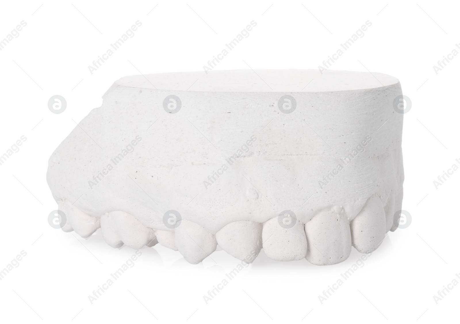 Photo of Dental model with gum isolated on white. Cast of teeth