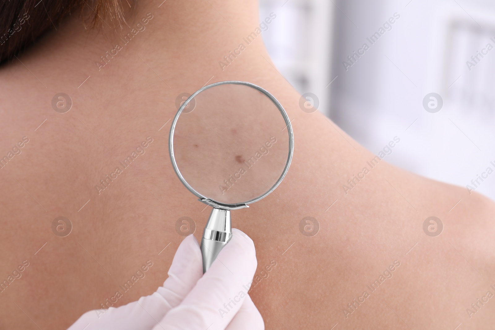 Photo of Dermatologist examining patient with magnifying glass in clinic, closeup view