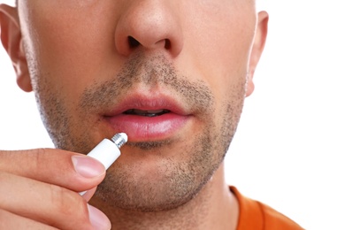 Young man with cold sore applying cream on lips against white background, closeup