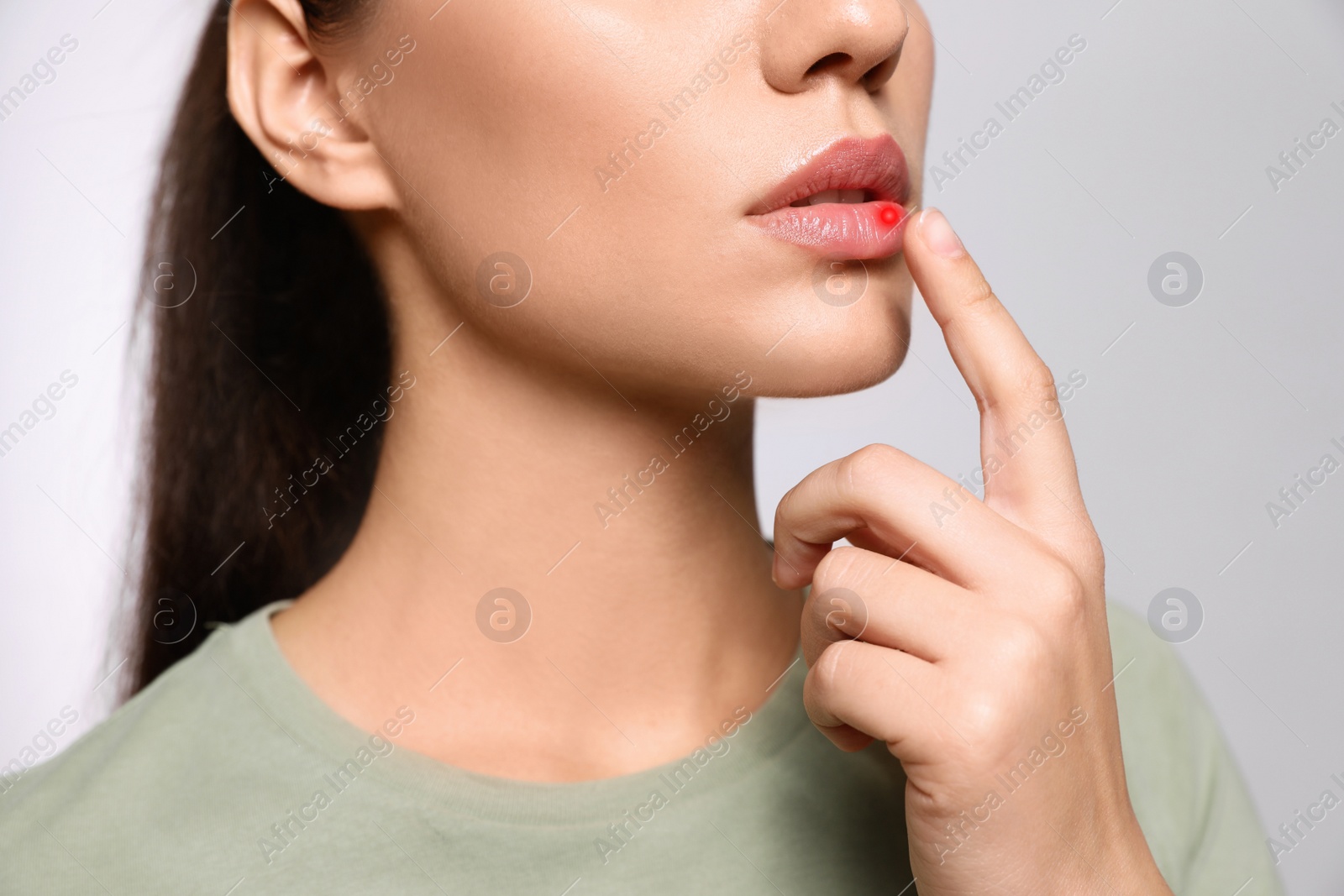 Image of Woman with herpes touching lip on light grey background, closeup