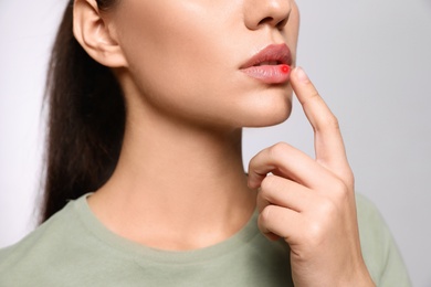 Woman with herpes touching lip on light grey background, closeup