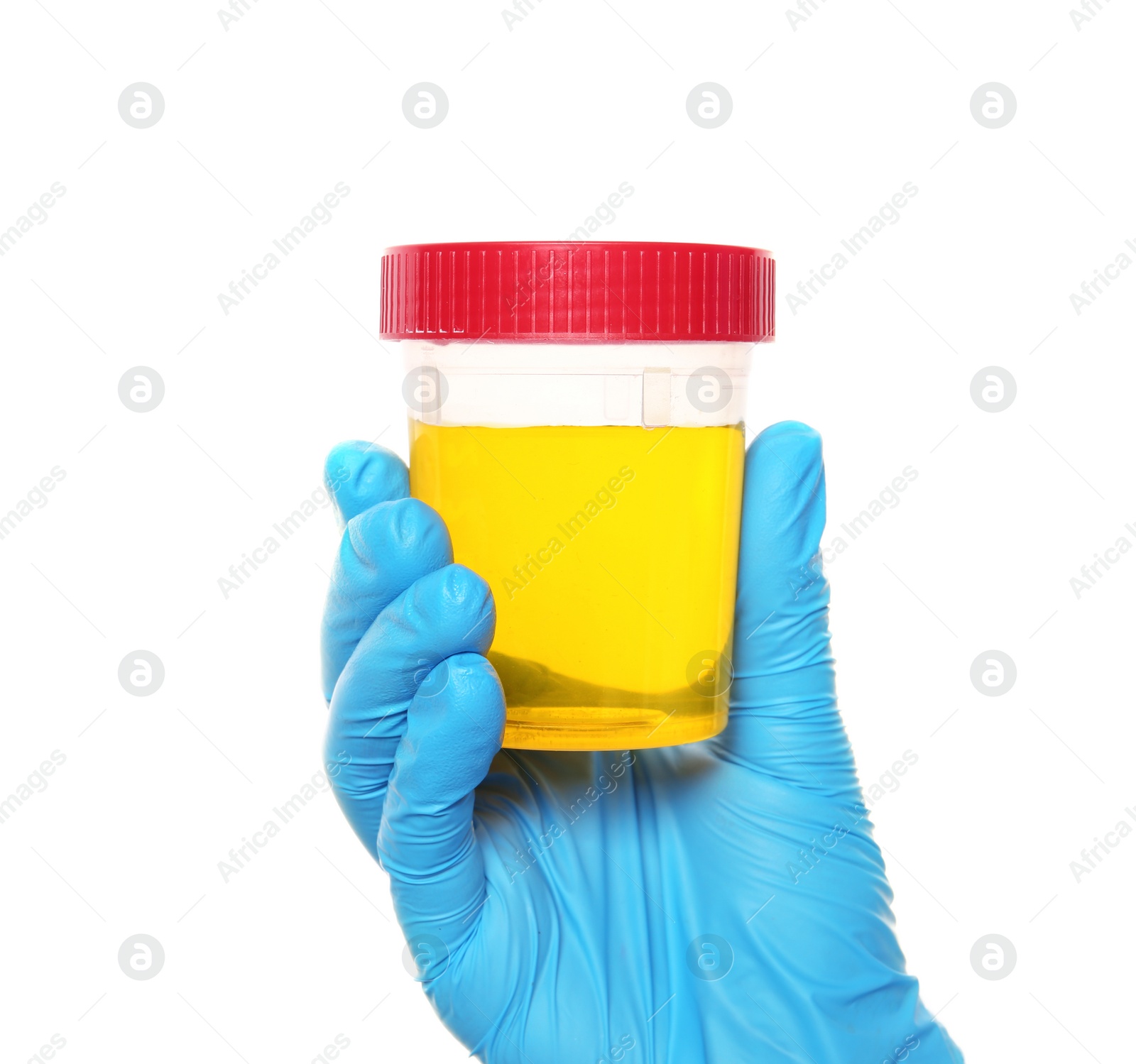 Photo of Laboratory assistant holding container with urine sample for analysis on white background, closeup
