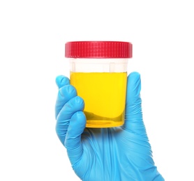 Photo of Laboratory assistant holding container with urine sample for analysis on white background, closeup