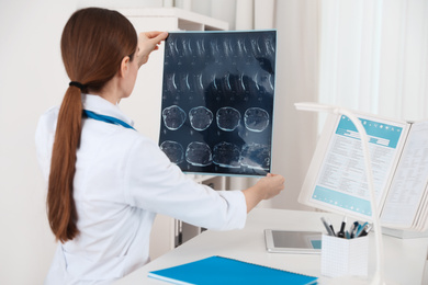 Photo of Orthopedist examining X-ray picture at desk in clinic