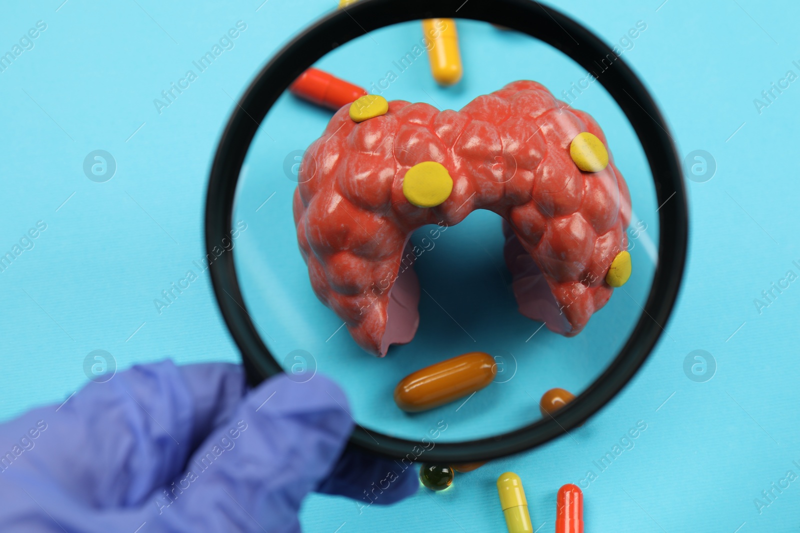 Photo of Endocrinologist looking at model of thyroid gland and capsules through magnifying glass on light blue background, closeup