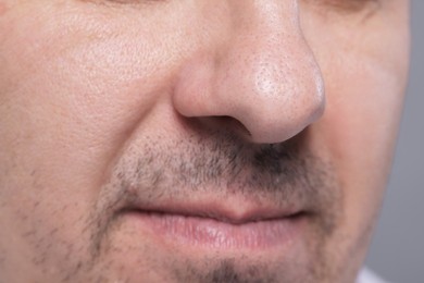 Photo of Closeup view of man with normal skin on grey background