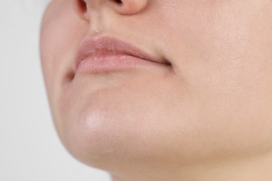 Woman with dry skin on white background, closeup view