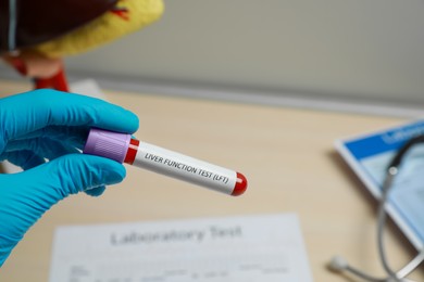 Laboratory worker holding tube with blood sample and label Liver Function Test over table, closeup