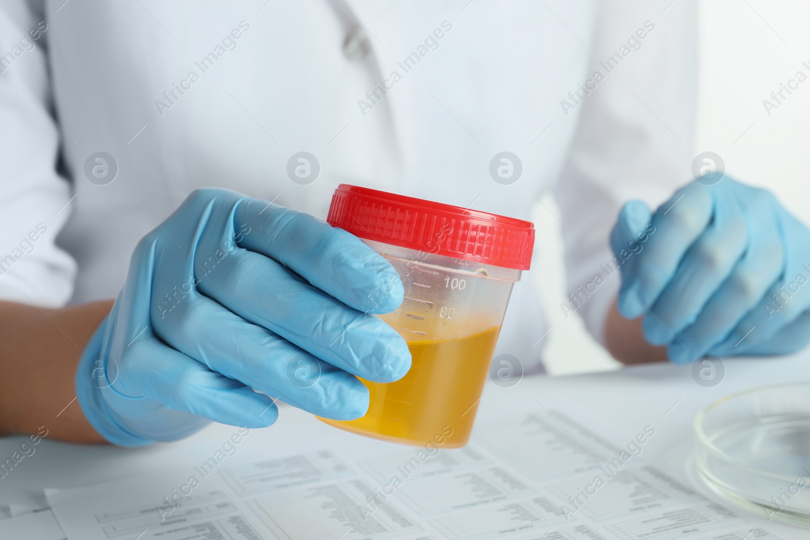 Photo of Nurse holding container with urine sample for analysis at table, closeup