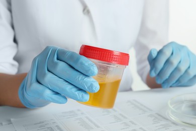Photo of Nurse holding container with urine sample for analysis at table, closeup