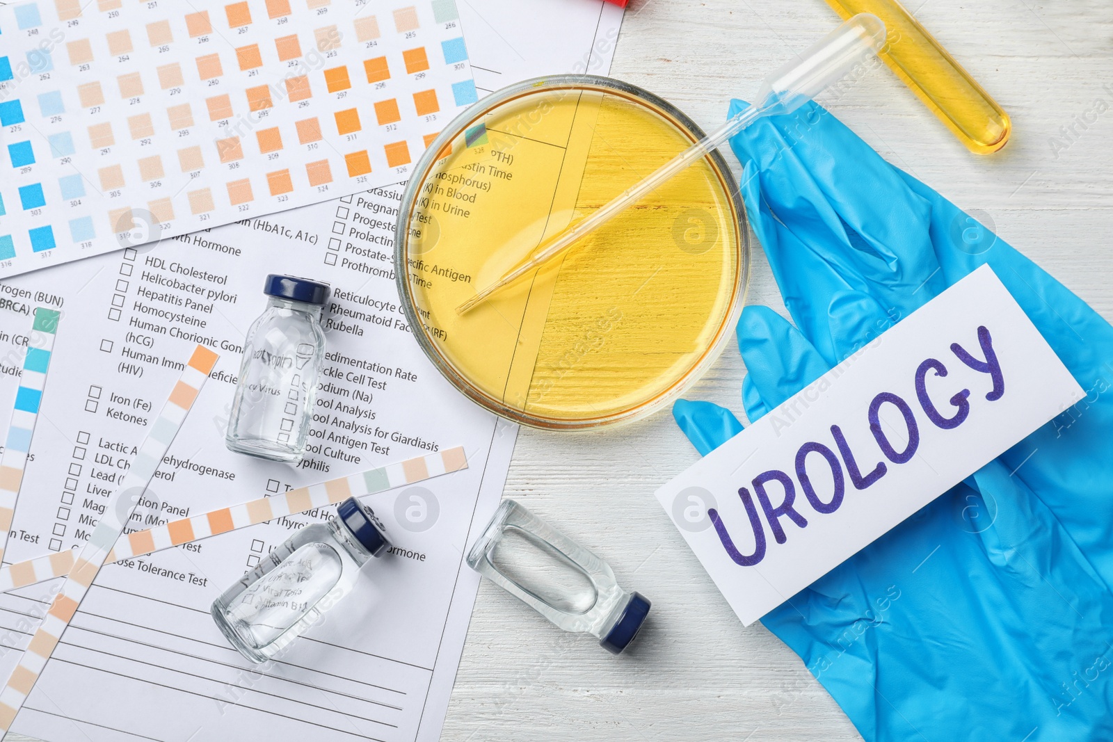 Photo of Flat lay composition with laboratory equipment and urine samples on light background. Urology concept