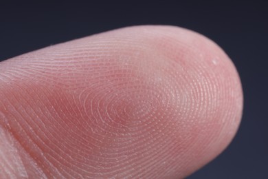 Finger with friction ridges on dark background, macro view