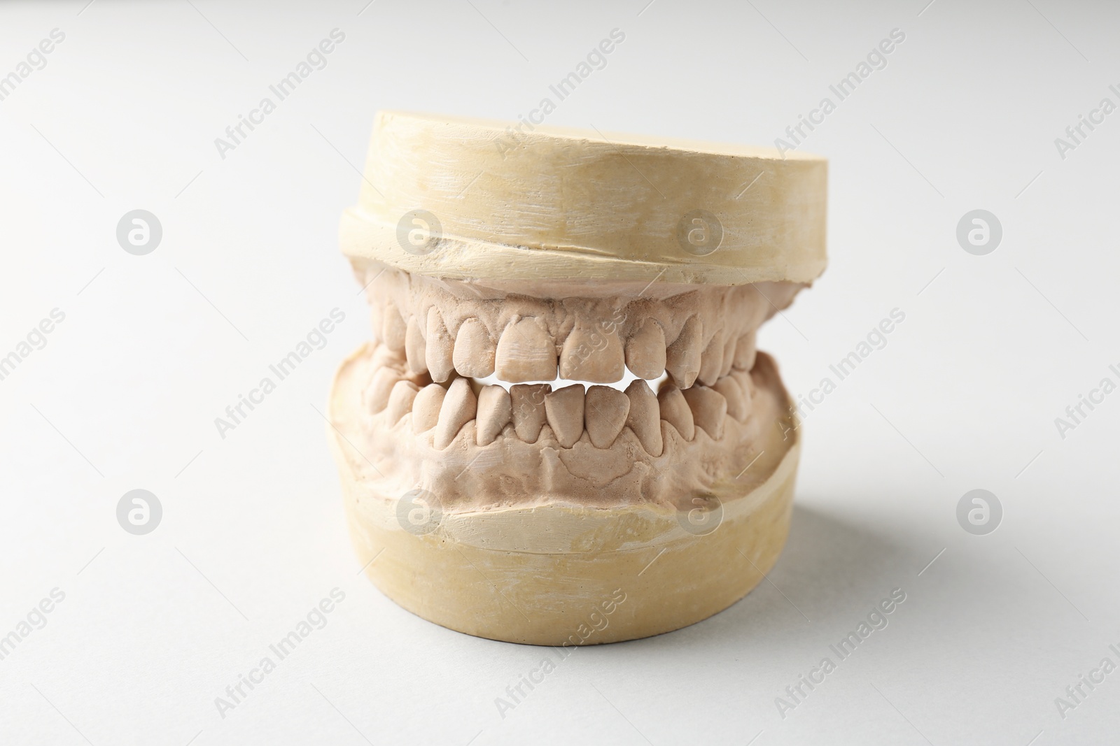 Photo of Dental model with gums on light grey background. Cast of teeth