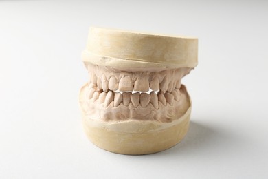 Photo of Dental model with gums on light grey background. Cast of teeth