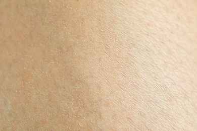 Photo of Texture of clean human skin, closeup view