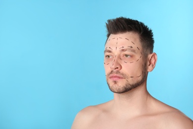 Photo of Man with marks on face for cosmetic surgery operation against blue background. Space for text