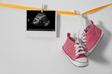 Photo of Ultrasound photo and baby sneakers hanging on ribbon against white background