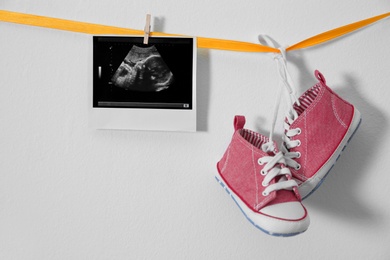 Ultrasound photo and baby sneakers hanging on ribbon against white background