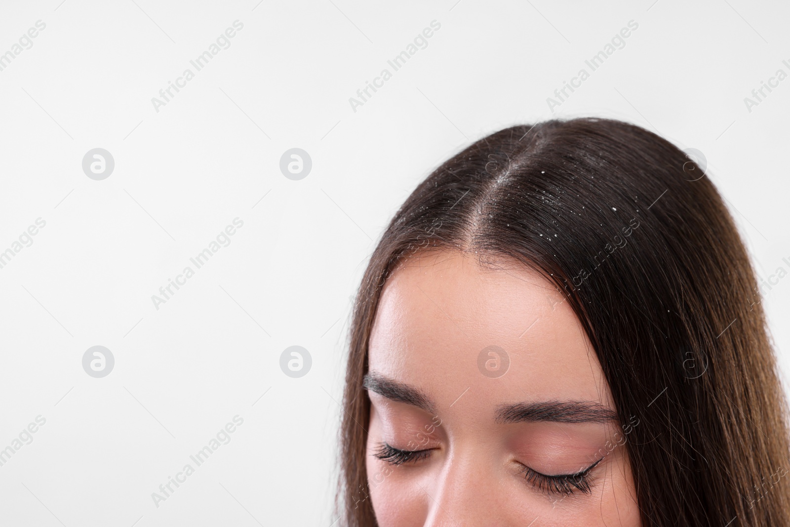 Photo of Woman with dandruff problem on white background, closeup. Space for text