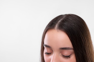 Woman with dandruff problem on white background, closeup. Space for text