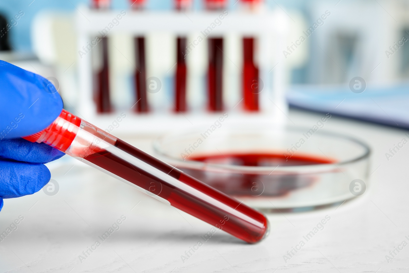 Photo of Scientist holding test tube with blood sample at table, closeup. Virus research