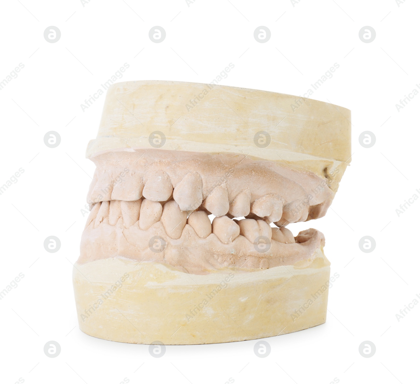 Photo of Dental model with jaws isolated on white. Cast of teeth