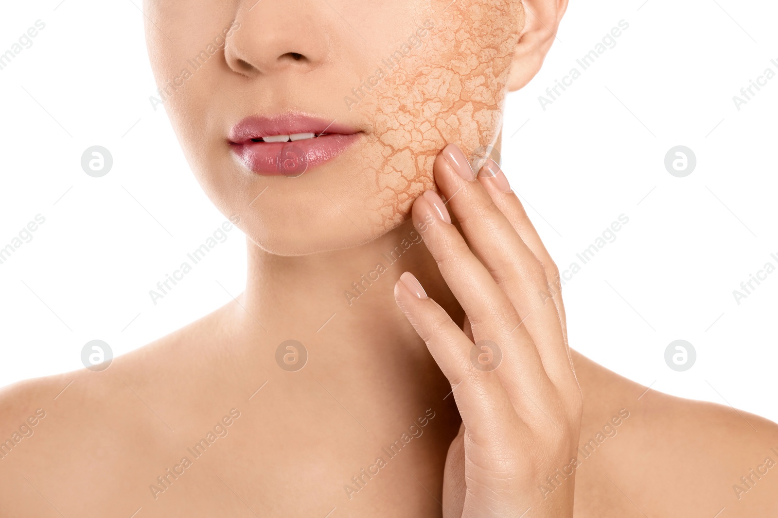 Image of Beautiful young woman with dry skin on white background, closeup