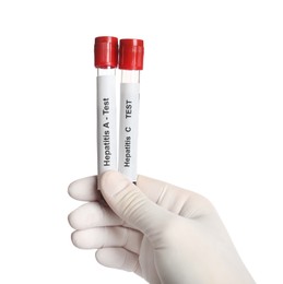 Scientist holding tubes with blood samples for hepatitis virus test on white background, closeup