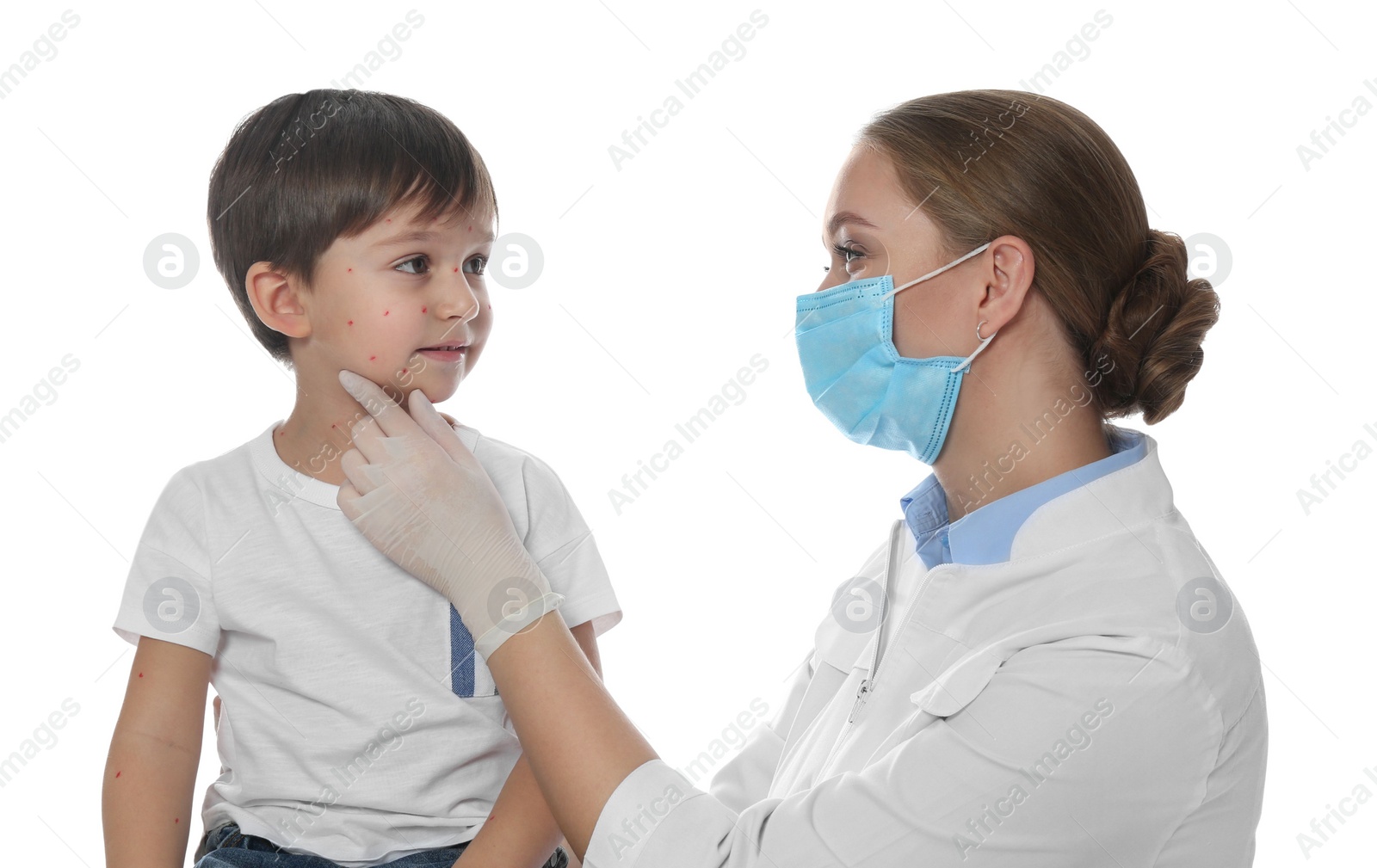 Photo of Doctor examining little boy with chickenpox on white background. Varicella zoster virus