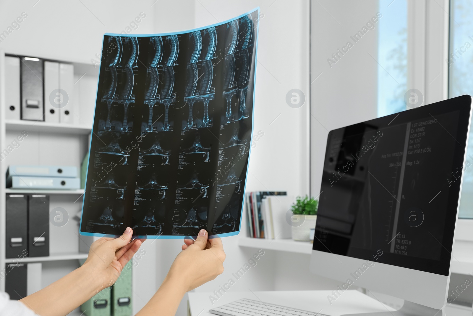 Photo of Doctor examining neck MRI image in clinic, closeup