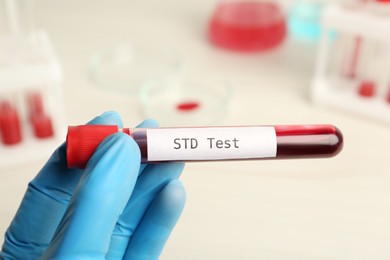 Scientist holding tube with blood sample and label STD Test on blurred background, closeup