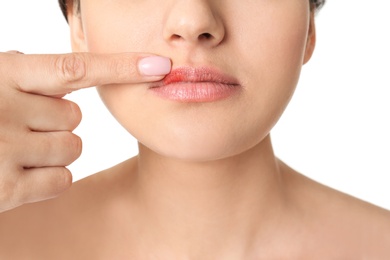 Woman with cold sore touching lips on white background, closeup
