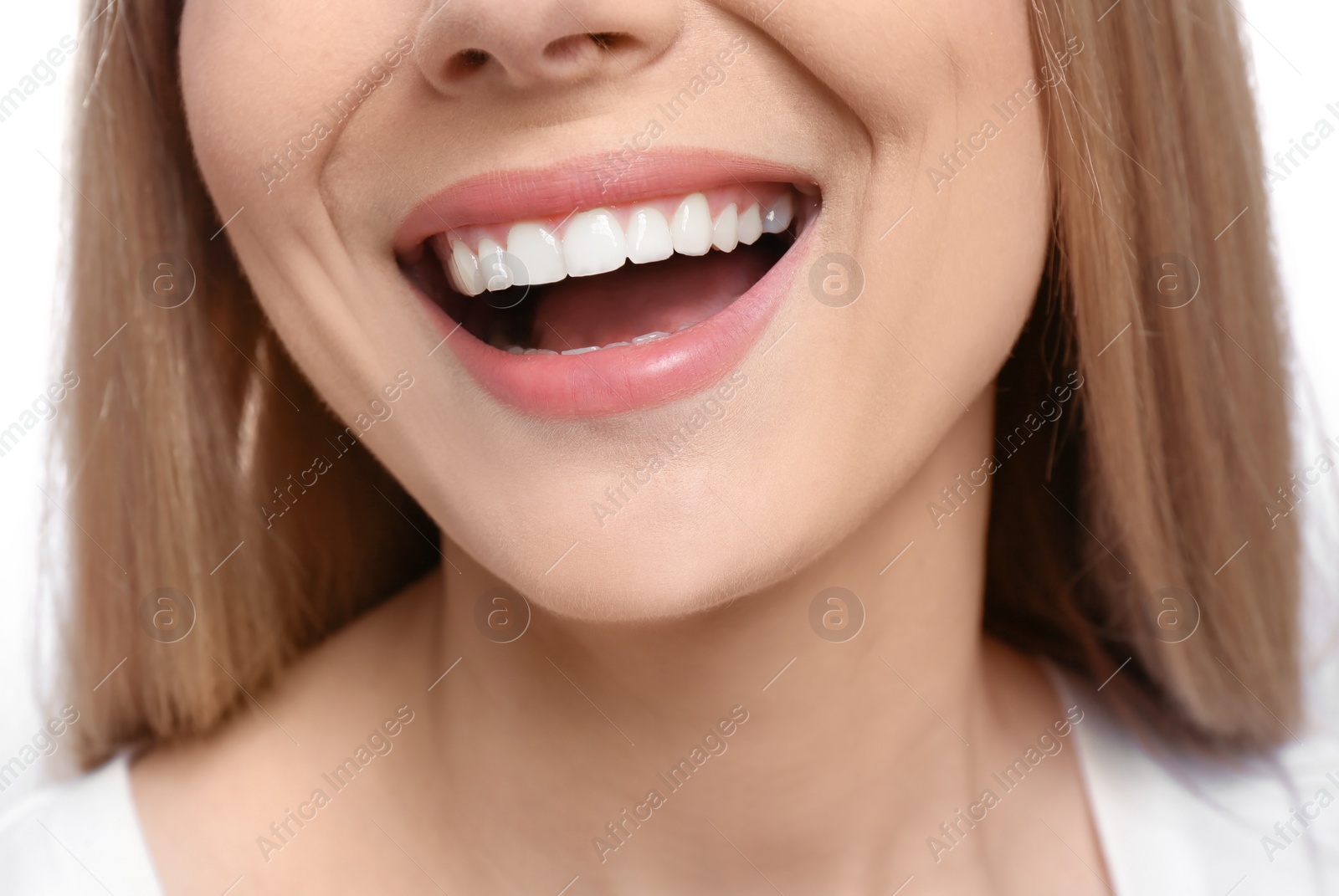 Photo of Young woman with beautiful smile, closeup. Teeth whitening