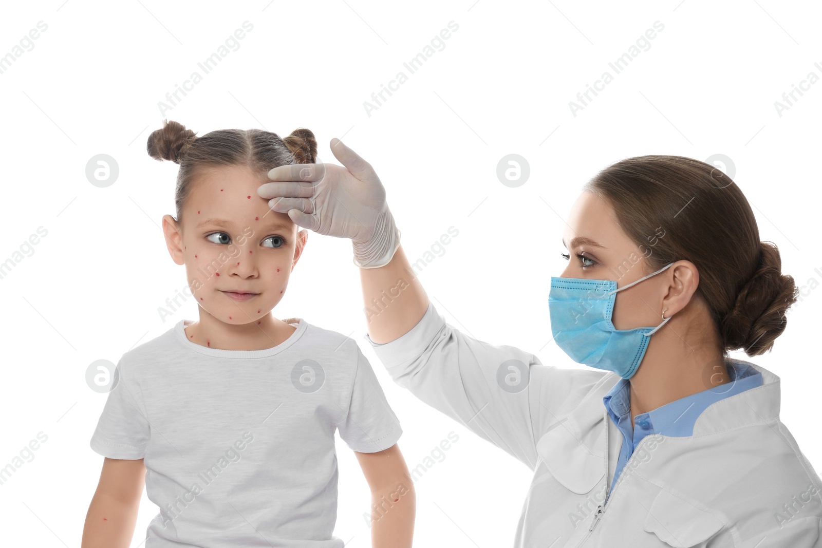 Photo of Doctor examining little girl with chickenpox on white background. Varicella zoster virus