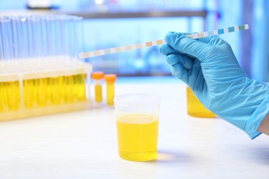 Photo of Laboratory assistant doing analysis with urine sample and litmus paper on table, closeup