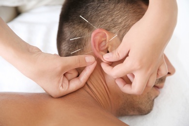 Young man undergoing acupuncture treatment in salon, closeup