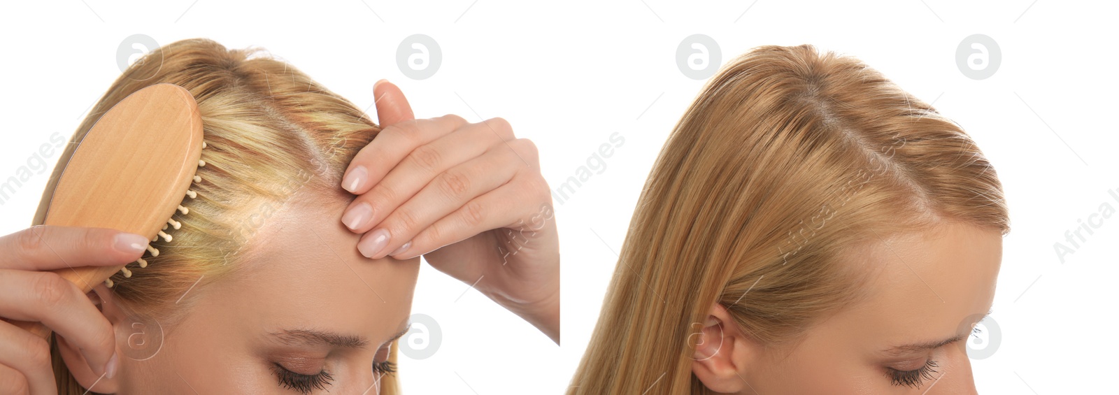 Image of Woman before and after hair treatment with high frequency darsonval device on white background, closeup. Collage of photos