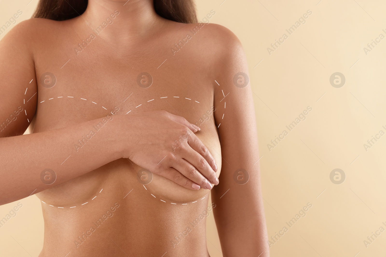 Image of Breast augmentation. Woman with markings for plastic surgery on skin against beige background, closeup. Space for text